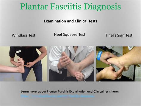 plantar fasciitis physical exam test